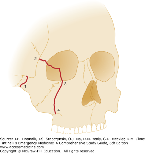 best of Paralytics and Facial fractures