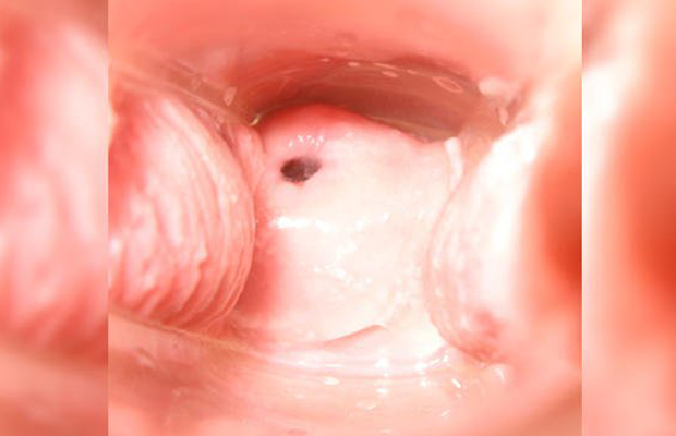 Penis mouths sperm behaier