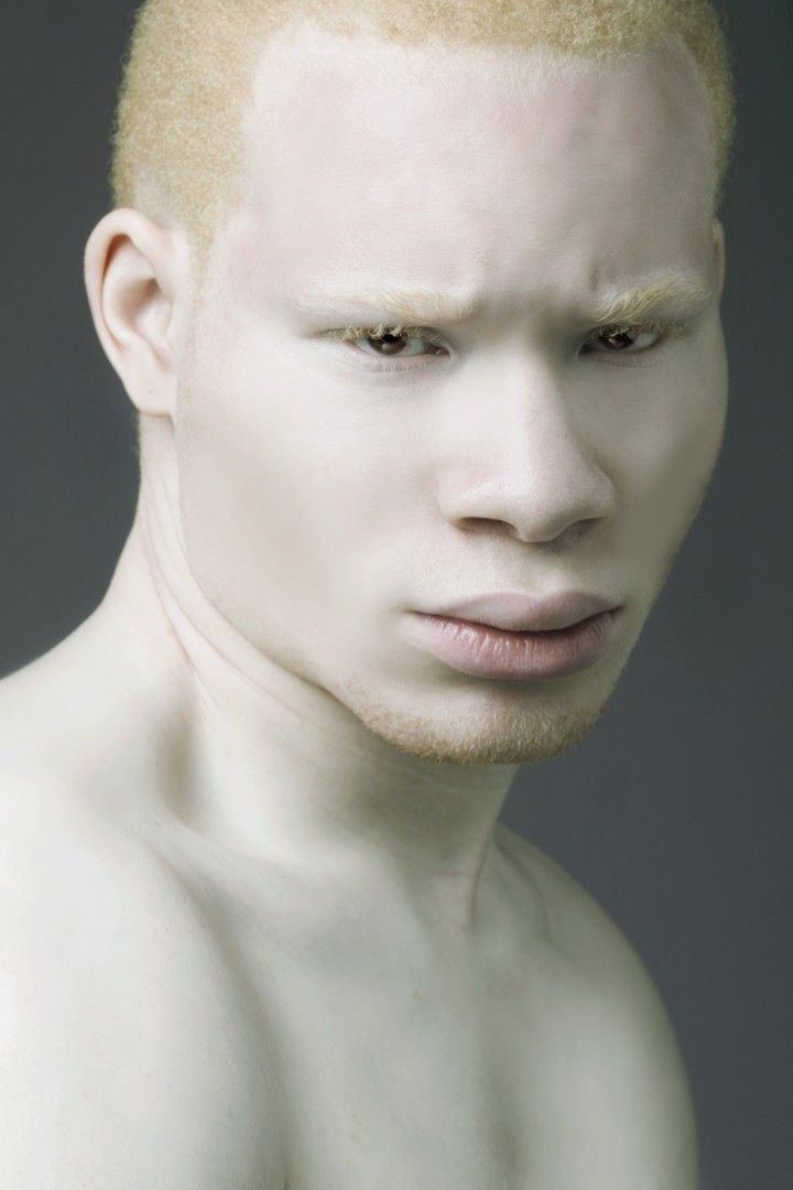 best of People Naked albino black