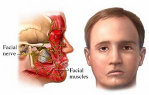 Miss G. reccomend Facial massage and bells palsy