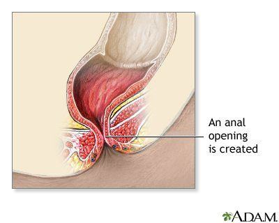 best of Of anus the pictures Medical