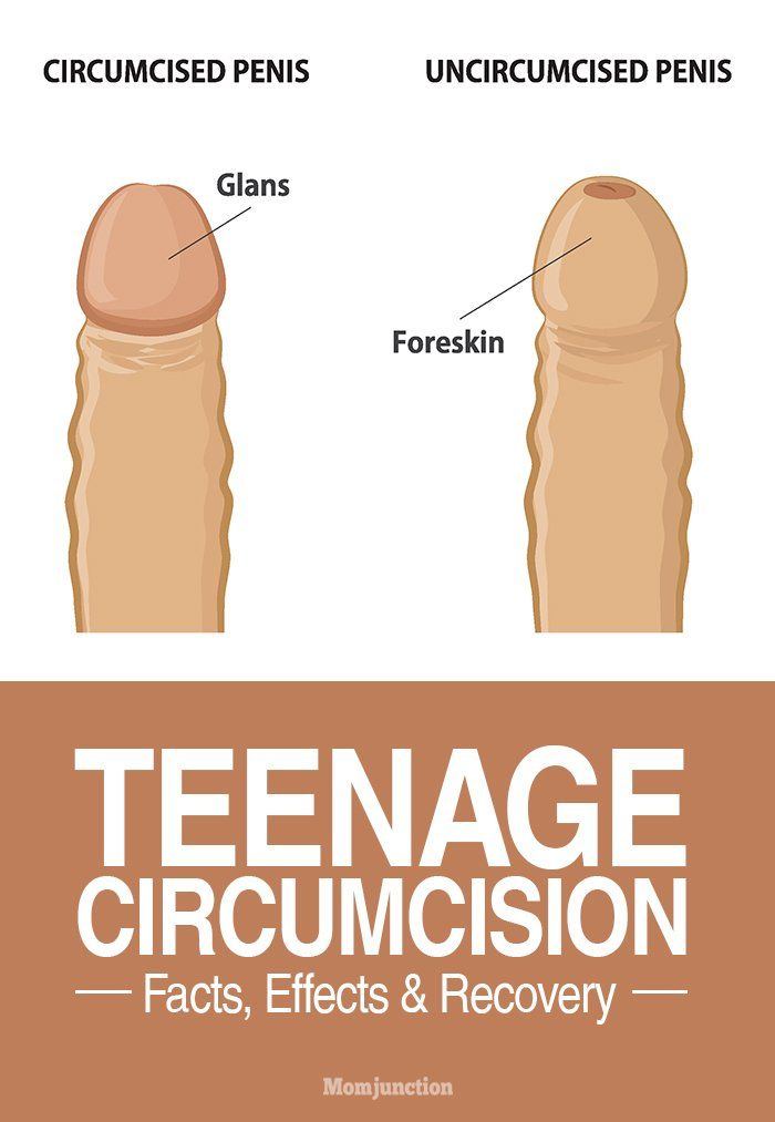 Erect Uncircumcised Penis - Telegraph.