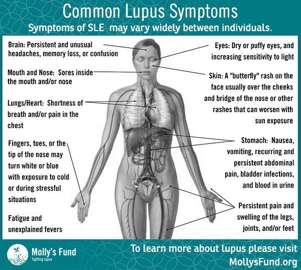 best of With Facial lupus pain