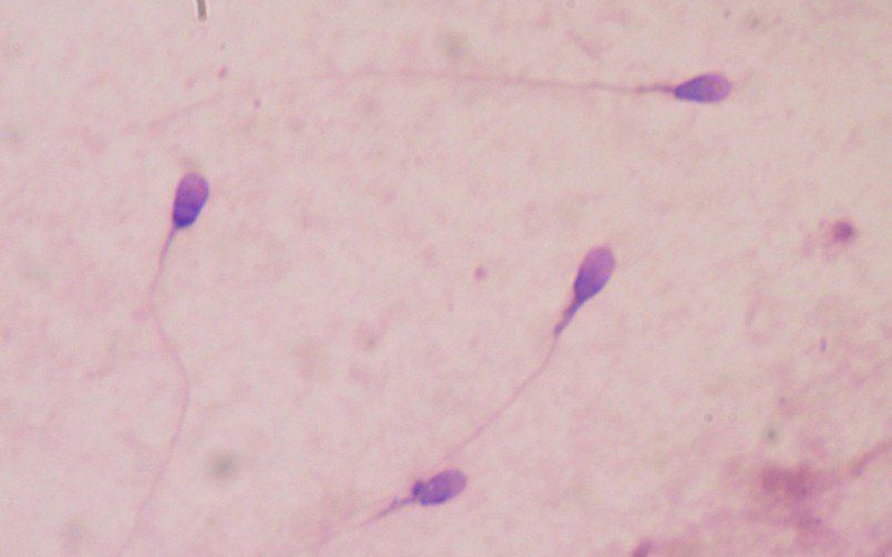 best of Microscope Sperm cells under
