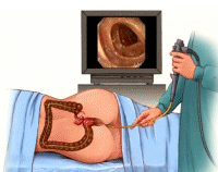 Colonoscopy of the vagina