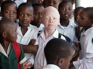 best of Girls tribe Albino african