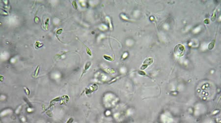 The E. Q. reccomend Healthy sperm under microscope