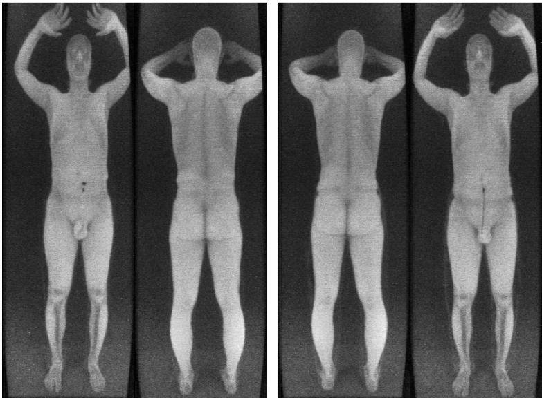 Airports with naked body scanners