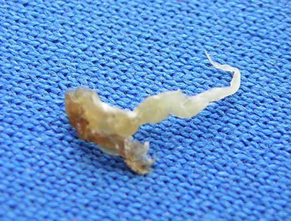 Pictures of a geckos sperm plug