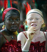 Albino african tribe girls