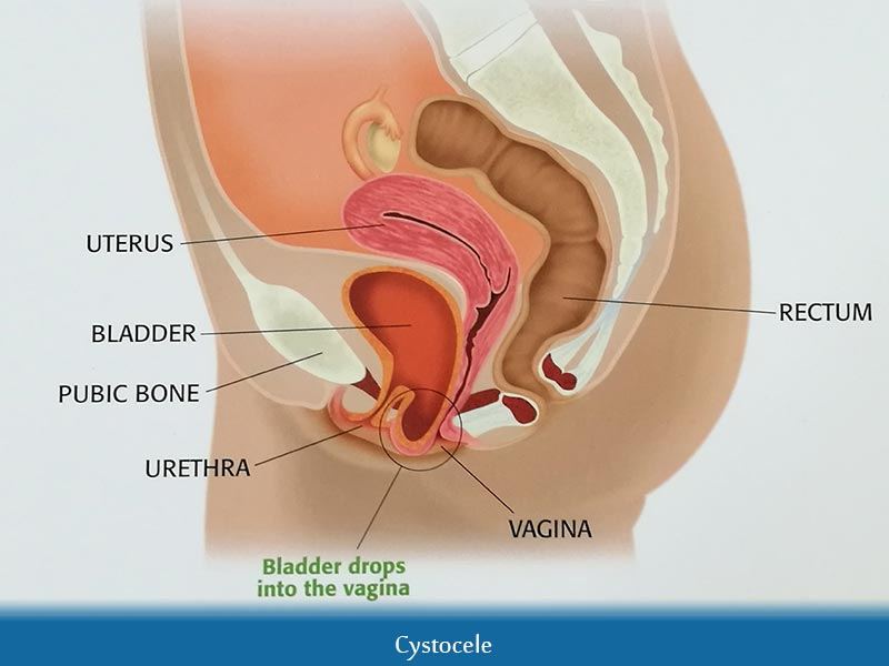 best of Vagina and Between uterus