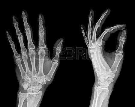 best of Adult hand left Xray male