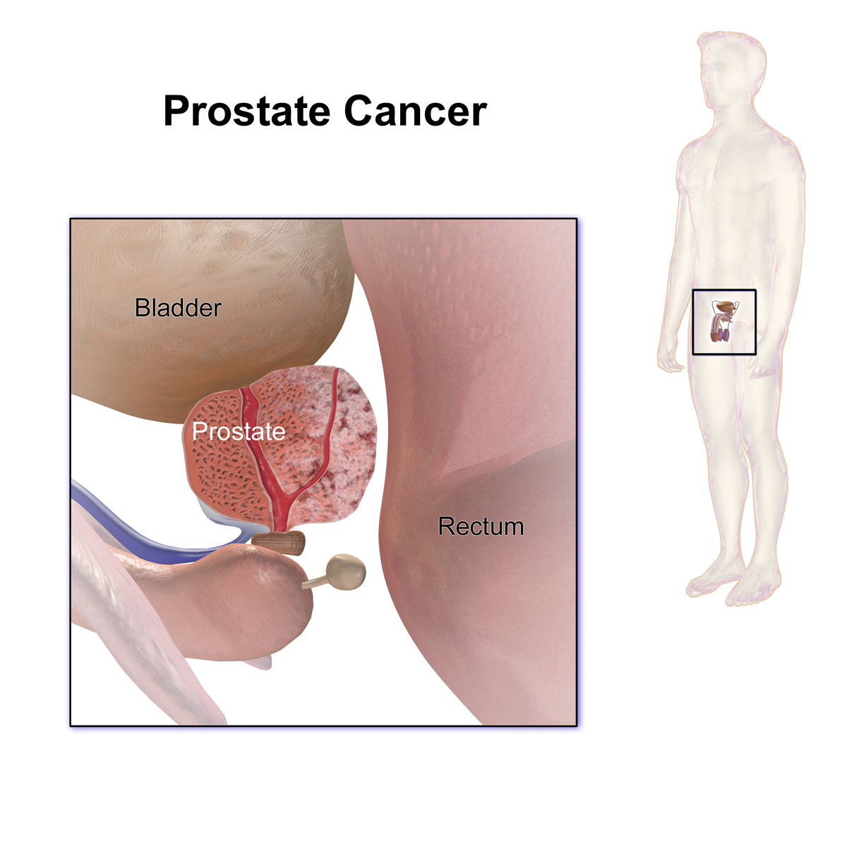 best of Prostate anus Male milking