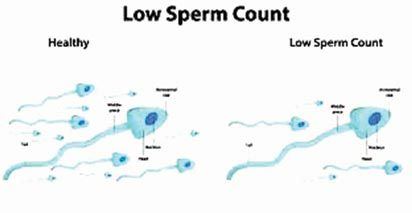 Tic T. reccomend Male sperm counts