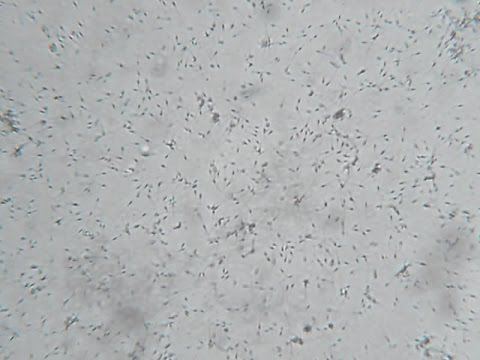 best of Microscope under Healthy sperm