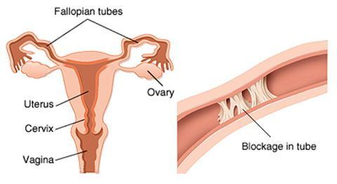 How to cure your lovely woman tube