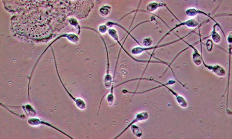 Sperm cells under microscope