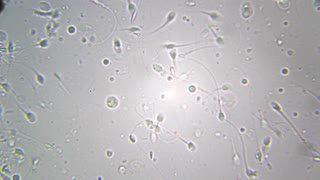 Sperm cells under microscope